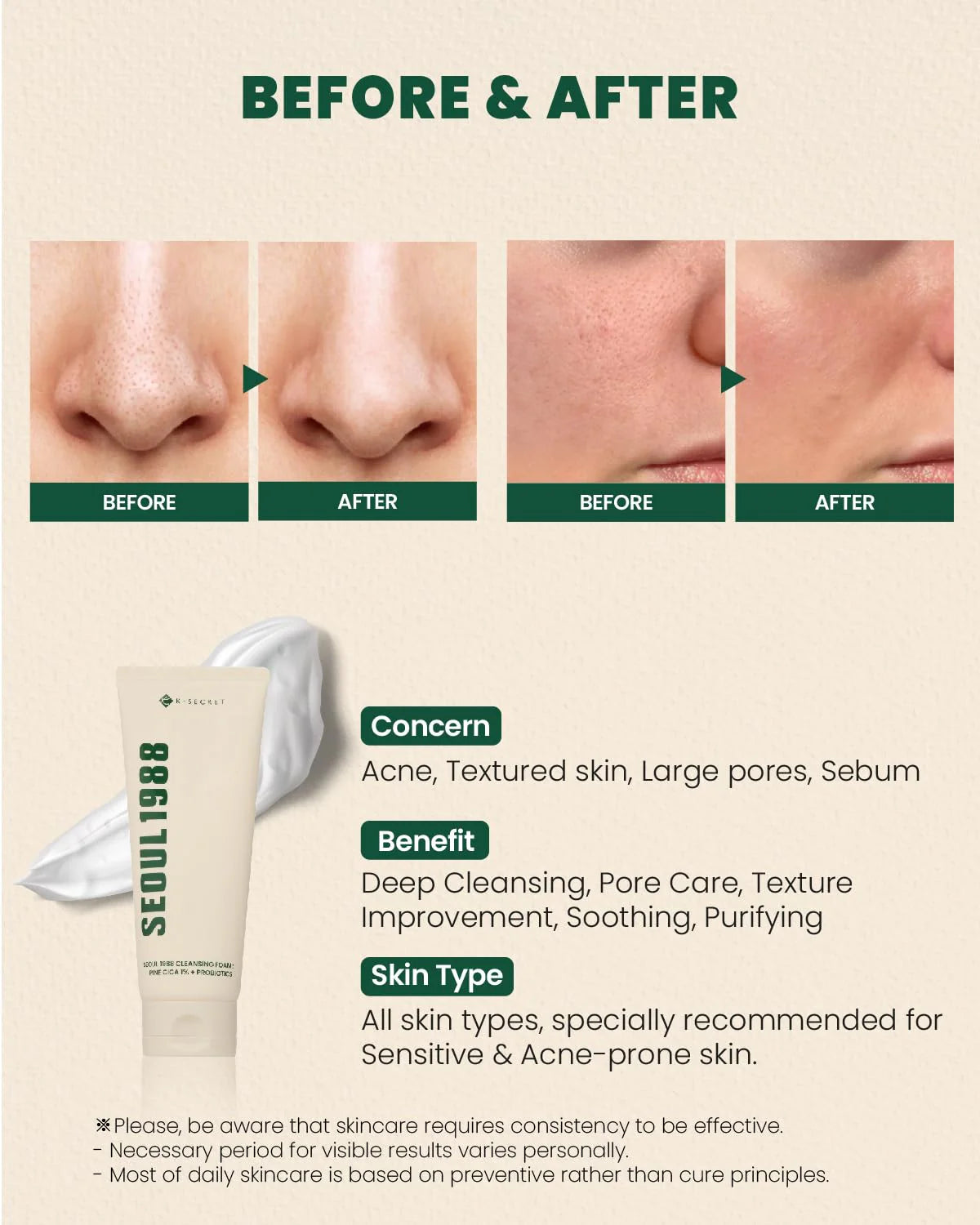 KSECRET SEOUL 1988 Cleansing Foam: Pine Cica 1% + Probiotics (150ml)