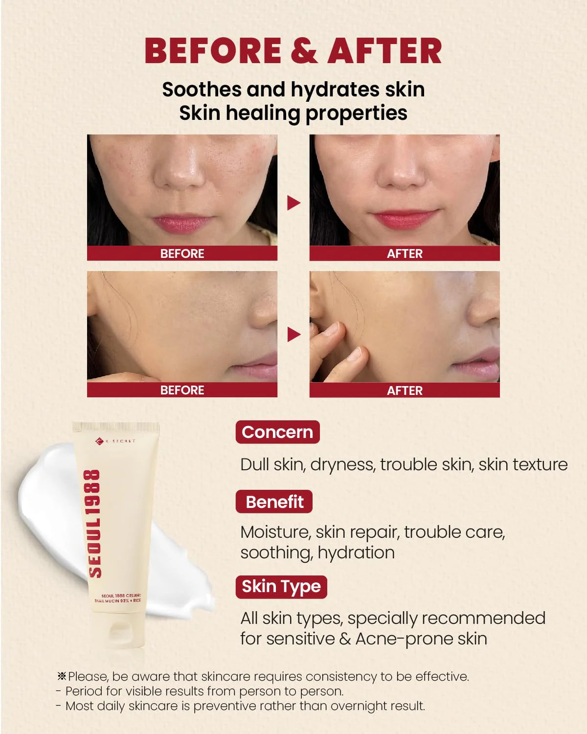 KSECRET SEOUL 1988 Cream: Snail Mucin 93% + Rice (100ml)