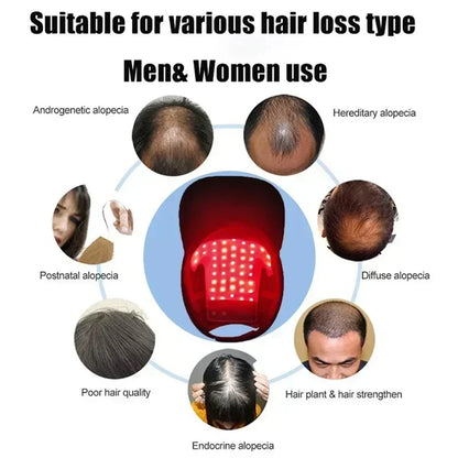 LED Hair Treatment Helmet – Red and Blue Light